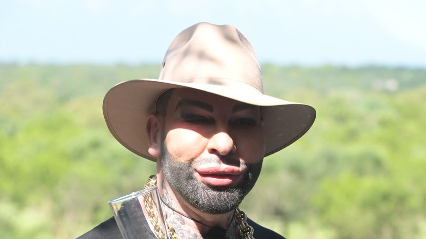 Dschungel-Diät: So viel Gewicht verlor Harald Glööckler!