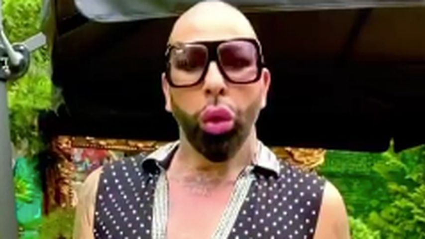 Huch! Harald Glööckler trägt jetzt eine stylishe Glatze!