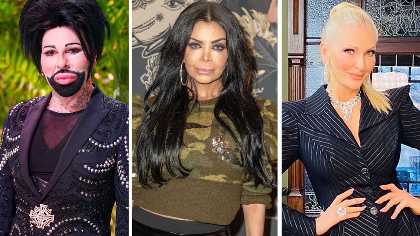 So sahen Glööckler, Kader und Désirée vor den Beauty-OPs aus