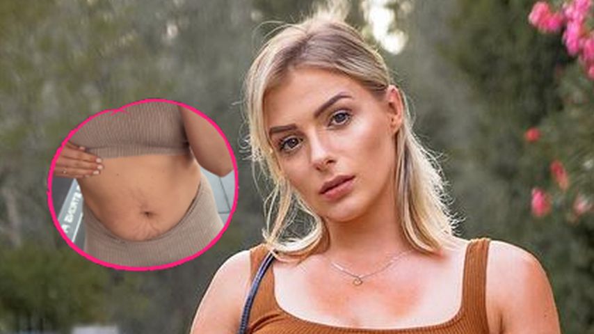 Böse Kommentare: HealthyMandy zeigt ihren After-Baby-Body