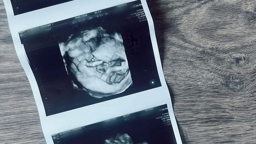 Heather Rae Youngs ungeborenes Kind im August 2022