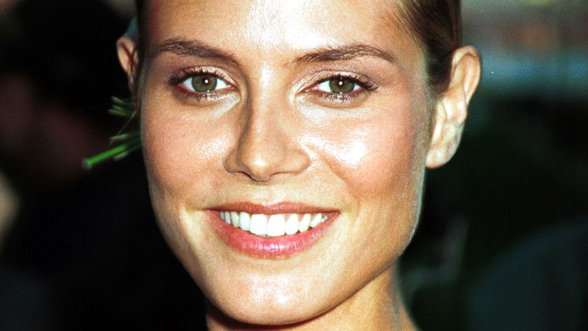 Wegen Pickeln: Heidi Klum als "Pizza-Gesicht" beschimpft
