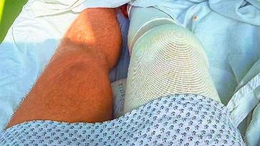 Hubert Fellas operiertes Knie, März 2026