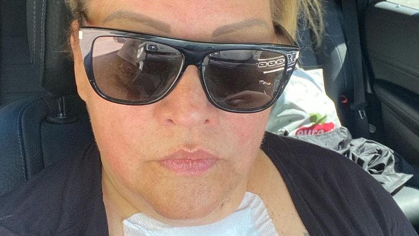 Post mit XXL-Pflaster: Ilka Bessin hatte eine Operation!