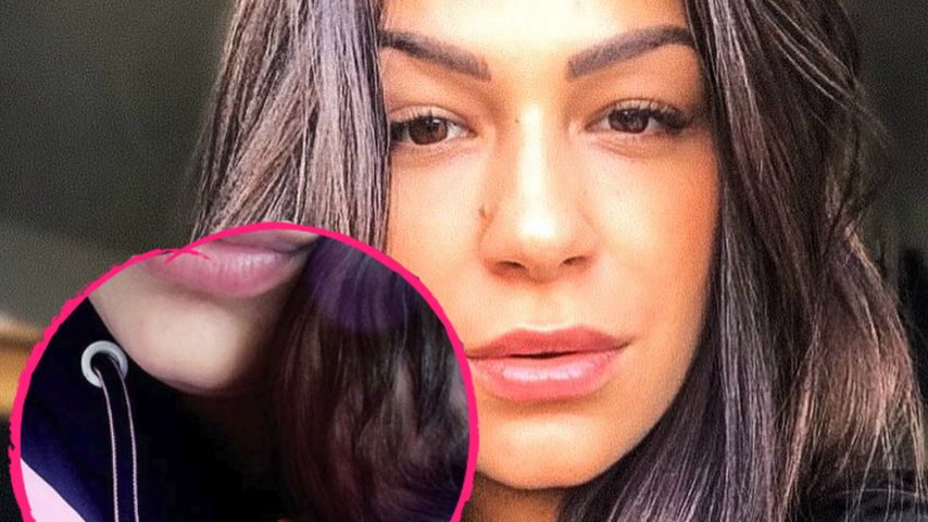Erstes Baby-Bild: Inci Sencer zeigt Neyla Sophies Köpfchen!