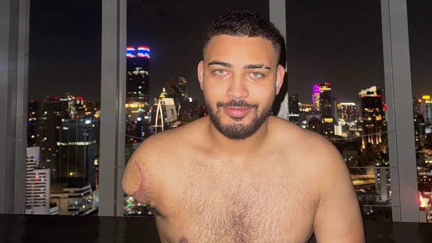 Influencer Justin Bunyai spricht offen über den Armverlust