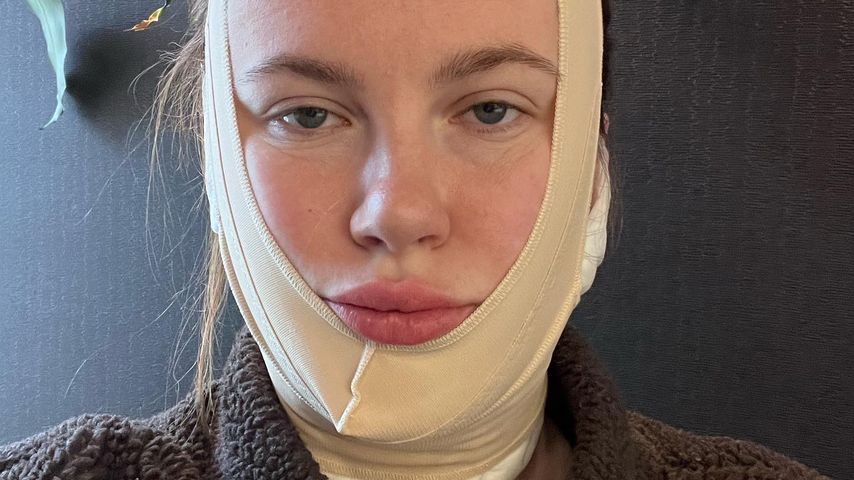Darum unterzog sich Ireland Baldwin mit 26 einem Facelifting