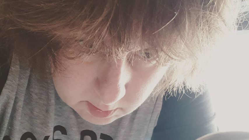 Nach Magenbypass: Iris Abel hat massive Probleme beim Essen