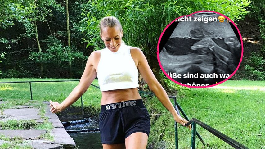 Via Ultraschallbild: Ex-"Köln 50667"-Star Iris zeigt Baby!