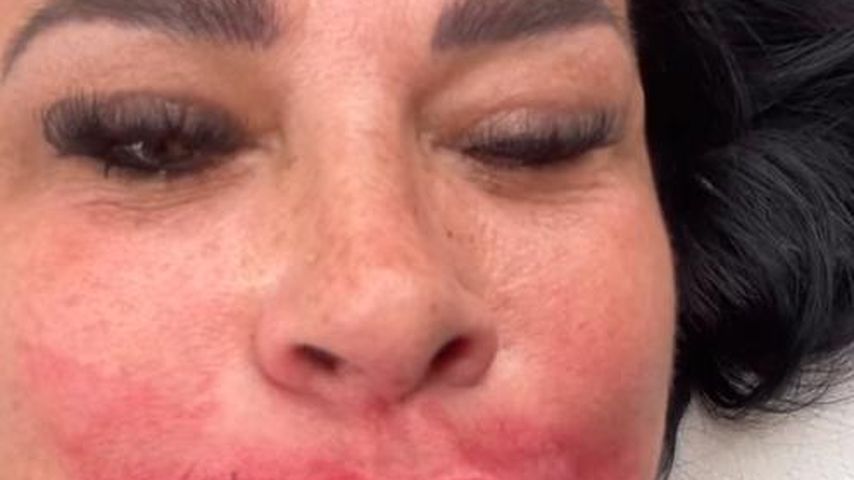Knutscht sie zu viel? Iris Kleins Lippen sind ganz wund