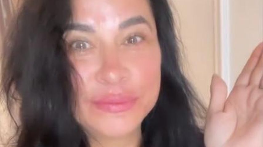 Make-over? Iris Klein hat sich Lippen aufspritzen lassen!