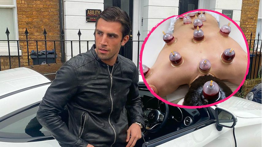 Echt jetzt? Jack Fincham lässt sich schröpfen bis aufs Blut