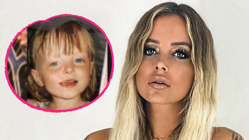 Hatte Bachelor-Girl Jade Übach schon immer ein Stupsnäschen?