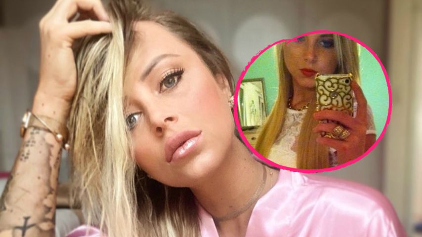 Vor XXL-Lippen: So sah Ex-Bachelor-Jade ohne Filler aus!