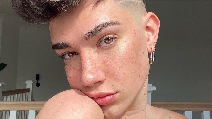 Zwei OPs auf einmal: Was hat James Charles machen lassen?