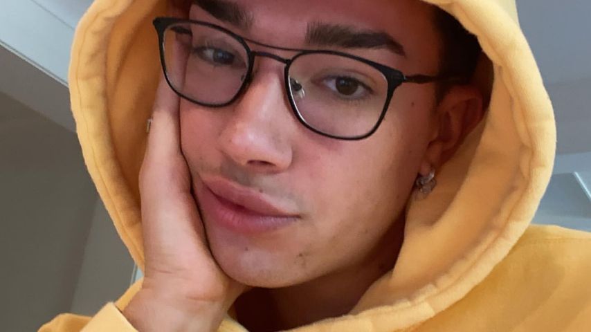Blondierungs-Fail: YouTuber James Charles fallen Haare aus!