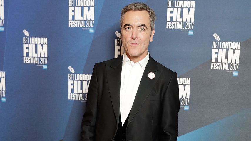 23.000 Euro: James Nesbitt lässt sich Haare transplantieren