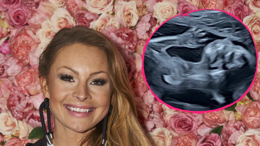Wie süß! Jana Schölermann teilt niedliches Ultraschallbild