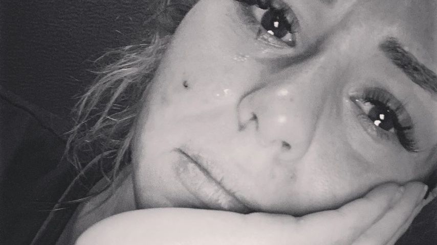 Bittere Tränen: Bachelor-Janines Hund von Pitbull attackiert