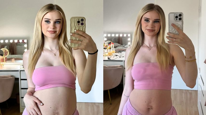 "Überwindung": So sieht Bauch von Jasi_xx3 nach Geburt aus