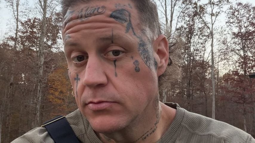 Jelly Roll nach Abnahme und ohne Bart.