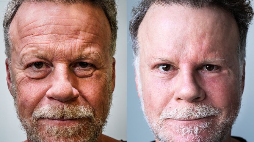 Jenke von Wilmsdorff vor und nach seinem Beauty-Experiment