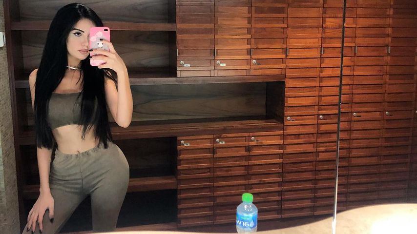 Beauty-Fail: Kim-Kardashian-Double hat nach OP "Fischlippen"