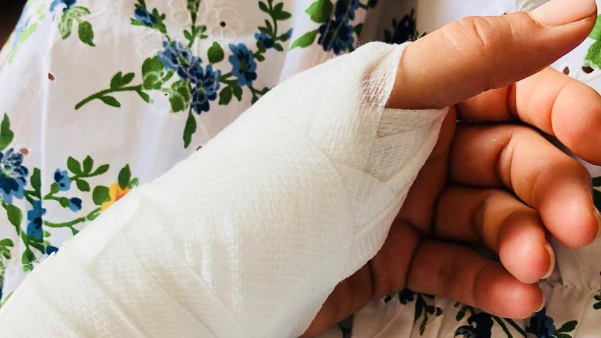 Jenny Elvers' Verband am Arm, Juni 2020