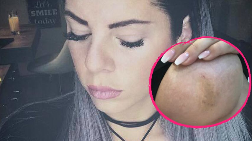 Trennungsgrund: Hat Hakan Jenny Frankhauser geschlagen?