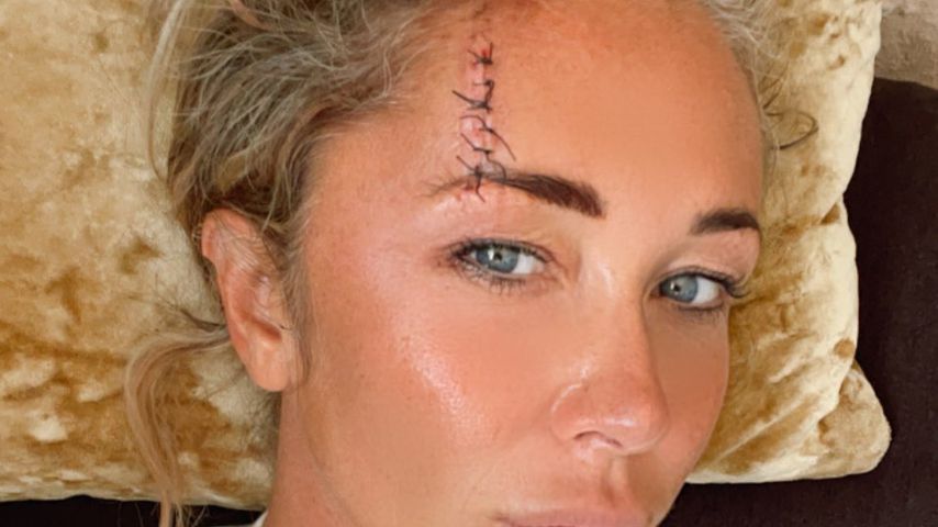 Kopfverletzung: Atomic-Kitten-Star Jenny Frost in Klinik