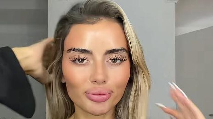 Fans lieben es: Jenny Grassl präsentiert Filler-Auflösung
