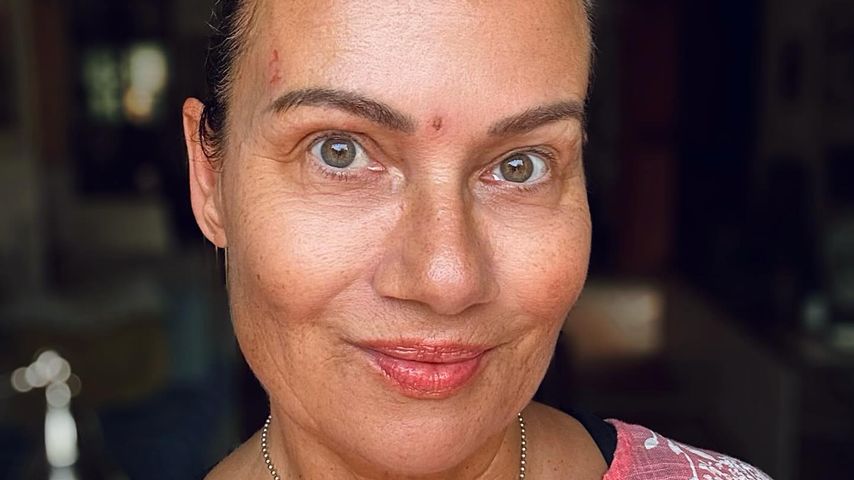 Wunden im Gesicht: Jenny Jürgens zeigt sich tapfer im Netz