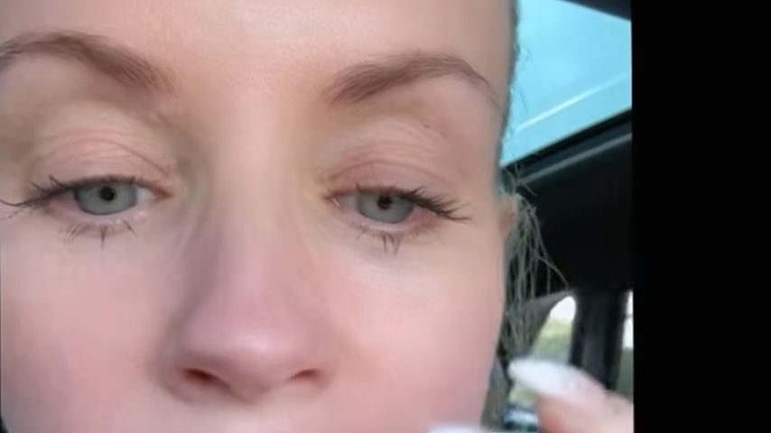 Jenny McCarthy mit stark angeschwollener Gesichtshälfte