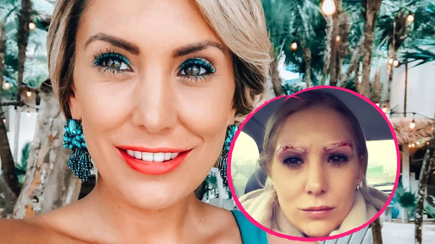 Horror-Tattooentfernung bei Ex-Bachelor-Babe Jenny Thiede