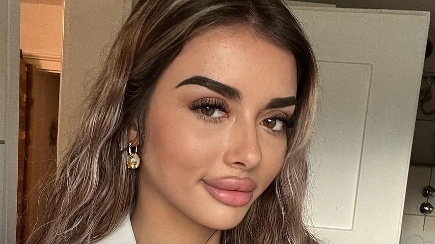 "Keine Selbstliebe": "Love Island"-Jenny über Beauty-OPs