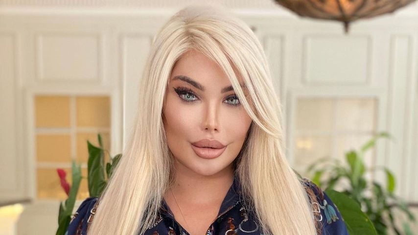 Jessica Alves wurden jetzt 75 Prozent ihres Magens entfernt