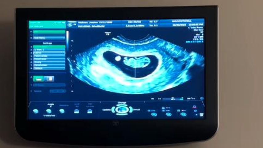 Jessica Grafs Ultraschall, Juli 2023