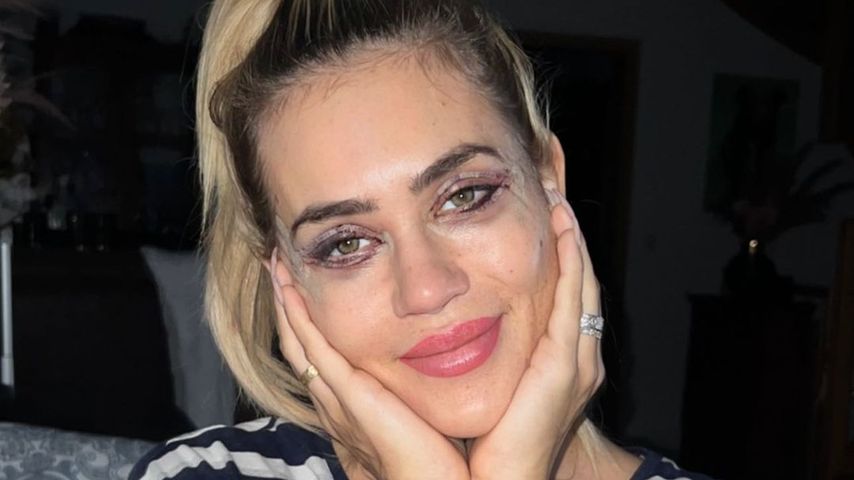 Lidstraffung? Jessica Haller hatte eine Beauty-OP im Gesicht