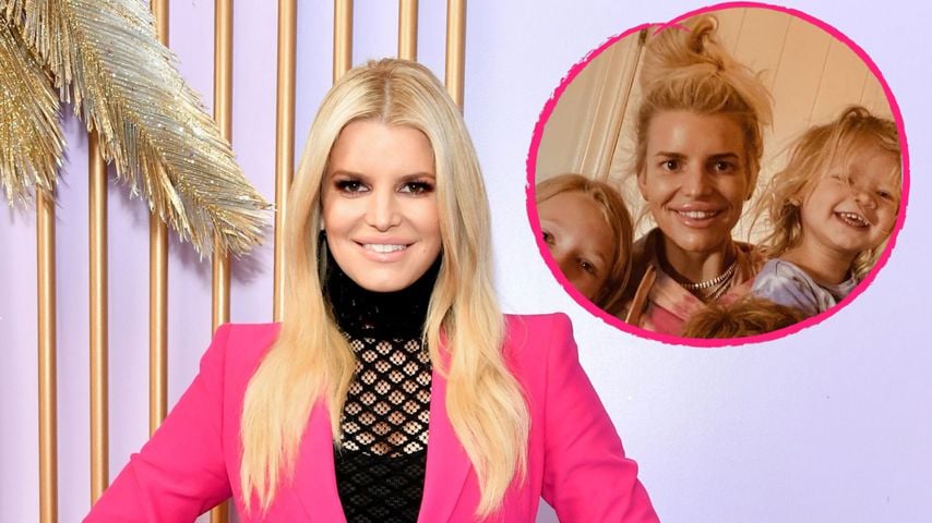 Beauty-Doc oder Photoshop? Jessica Simpson mit XXL-Lippen