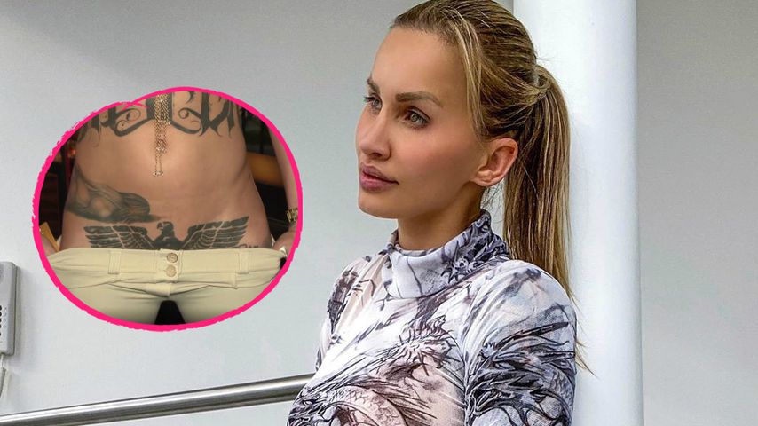 Instagram-Model ließ sich Reichsadler-Tattoo rausschneiden