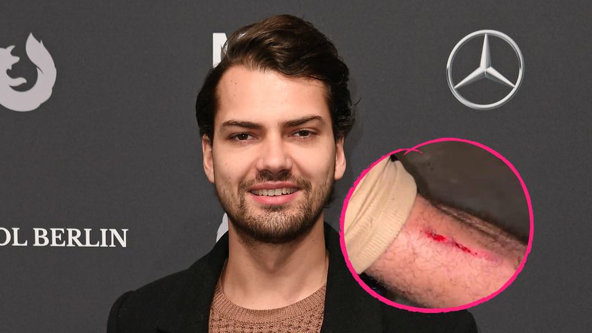 Aua! Jimi Blue verletzt sich bei Schlittenfahrt im Schnee
