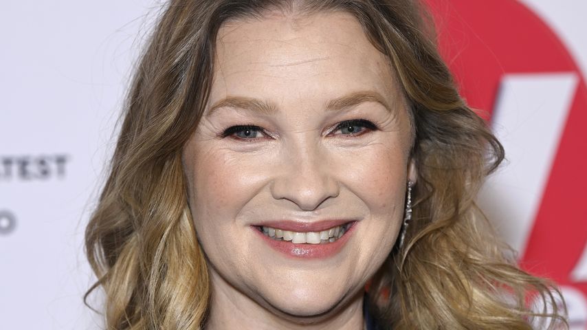 Joanna Page verbrannte sich heftig am Set
