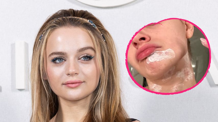 Joey King erleidet beim Kochen mit Öl Gesichtsverbrennungen