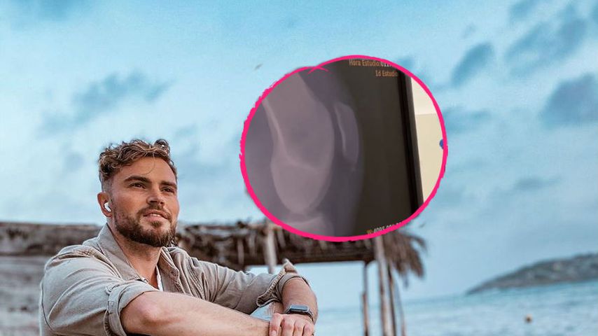 Klinik! Stück von Johannes Hallers Kniegelenk abgebrochen