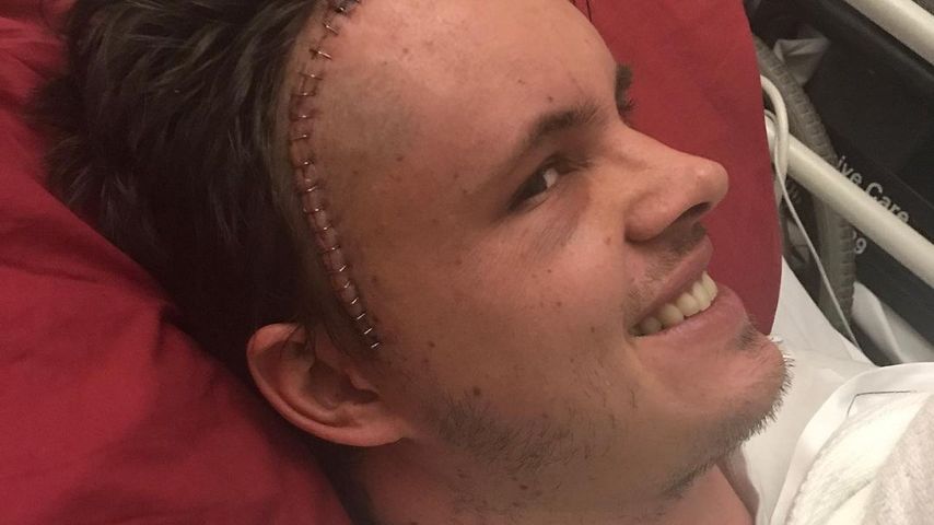 Johnny Ruffo nach seiner Not-OP im August 2017