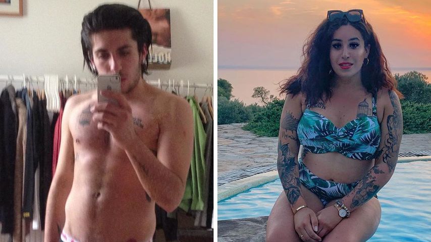Collage: Jolina Mennen vor ihren Operationen (links) und nach ihren Operationen (rechts)