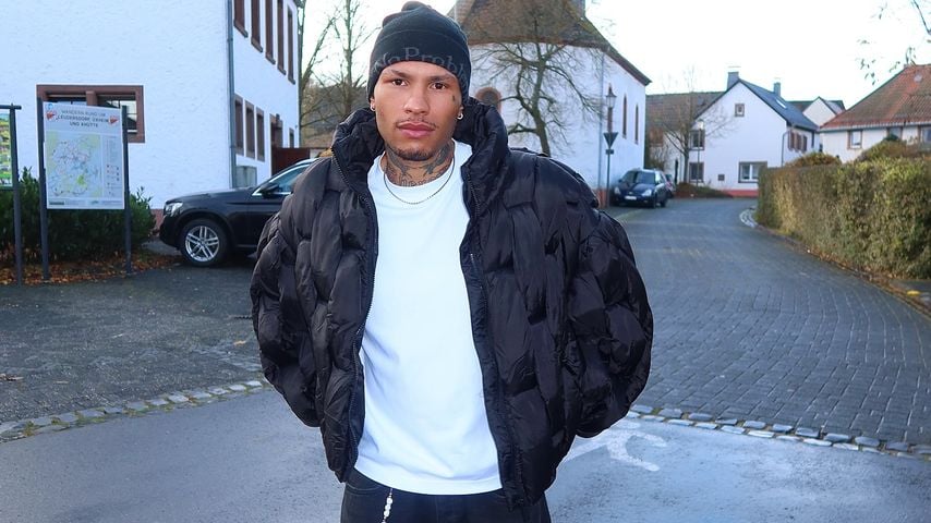 Darum wagte Jona Steinig seine zweite Haartransplantation