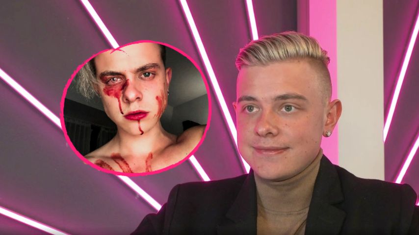 Bereut YouTuber Jonas Ems sein Menstruations-Blut-Foto?