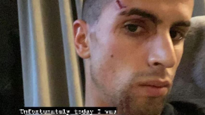João Cancelo nach dem Überfall auf seine Familie