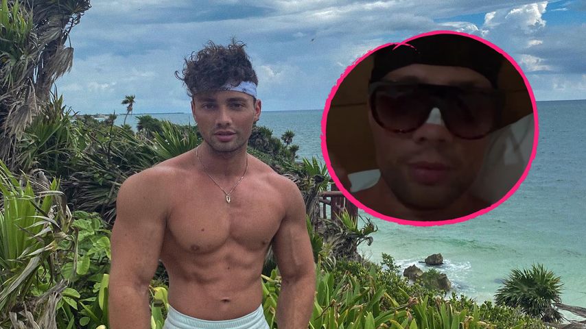 "Aus dem Nichts": "Love Island"-Josuas Nase wurde gebrochen!